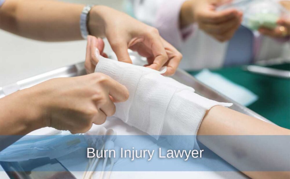 A medical professional carefully applies bandages to a patient's hand, highlighting the importance of proper care and legal support for burn injuries.