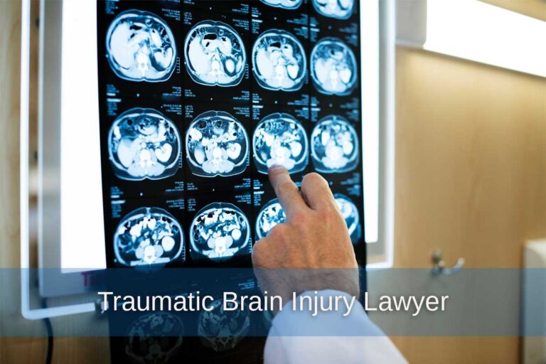 A physician highlights an X-ray on the wall, emphasizing details pertinent to traumatic brain injury legal cases.