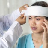 A woman with a bandaged head, representing common car accident injuries.