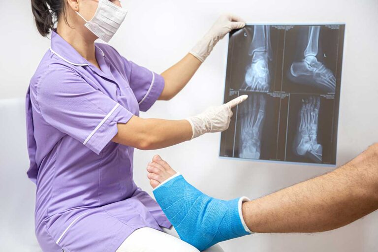 A woman with a foot cast examines an X-ray, reflecting on common car accident injuries.