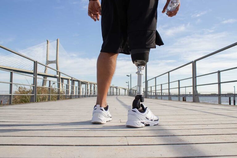 A man with a prosthetic leg strides along a bridge, representing strength and recovery from common car accident injuries.