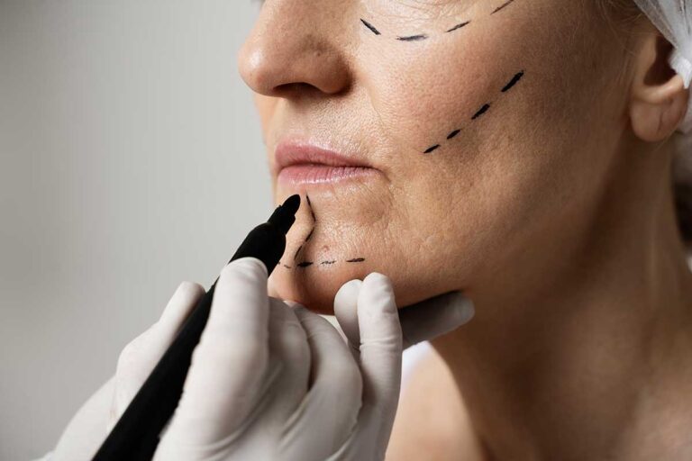 A plastic surgeon marks a woman's face, highlighting the importance of understanding associated risks with cosmetic procedures.