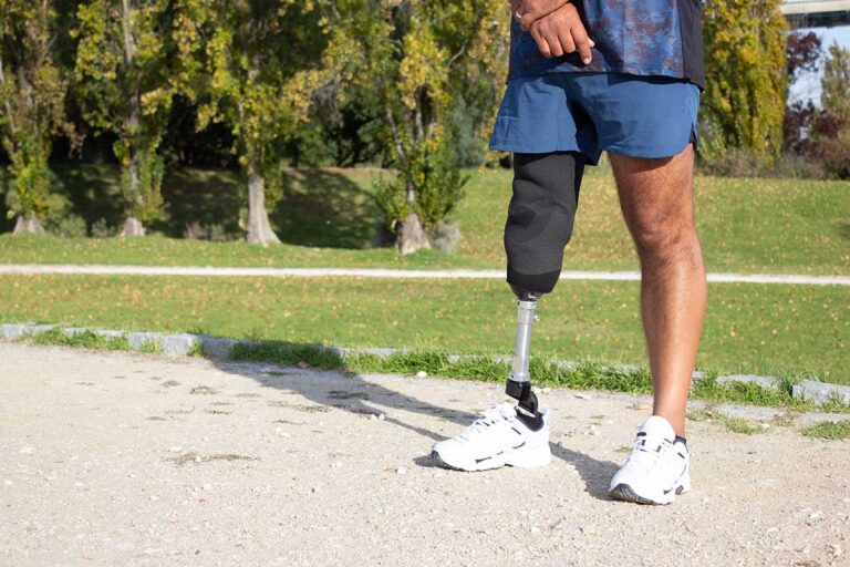 A man with a prosthetic leg stands confidently on a road, symbolizing resilience after catastrophic injuries in Georgia.