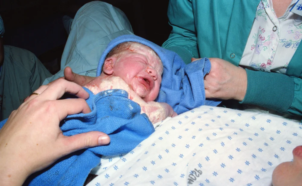 Birth Injury Lawsuit